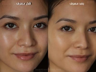 شفاف کردن پوست صورت
